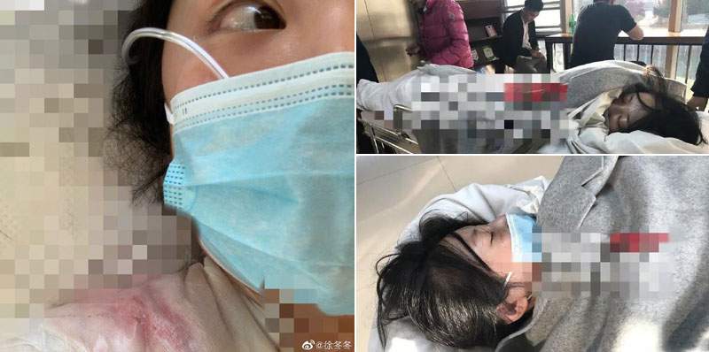 ��һɽ��ɩ�춬�����������¹�